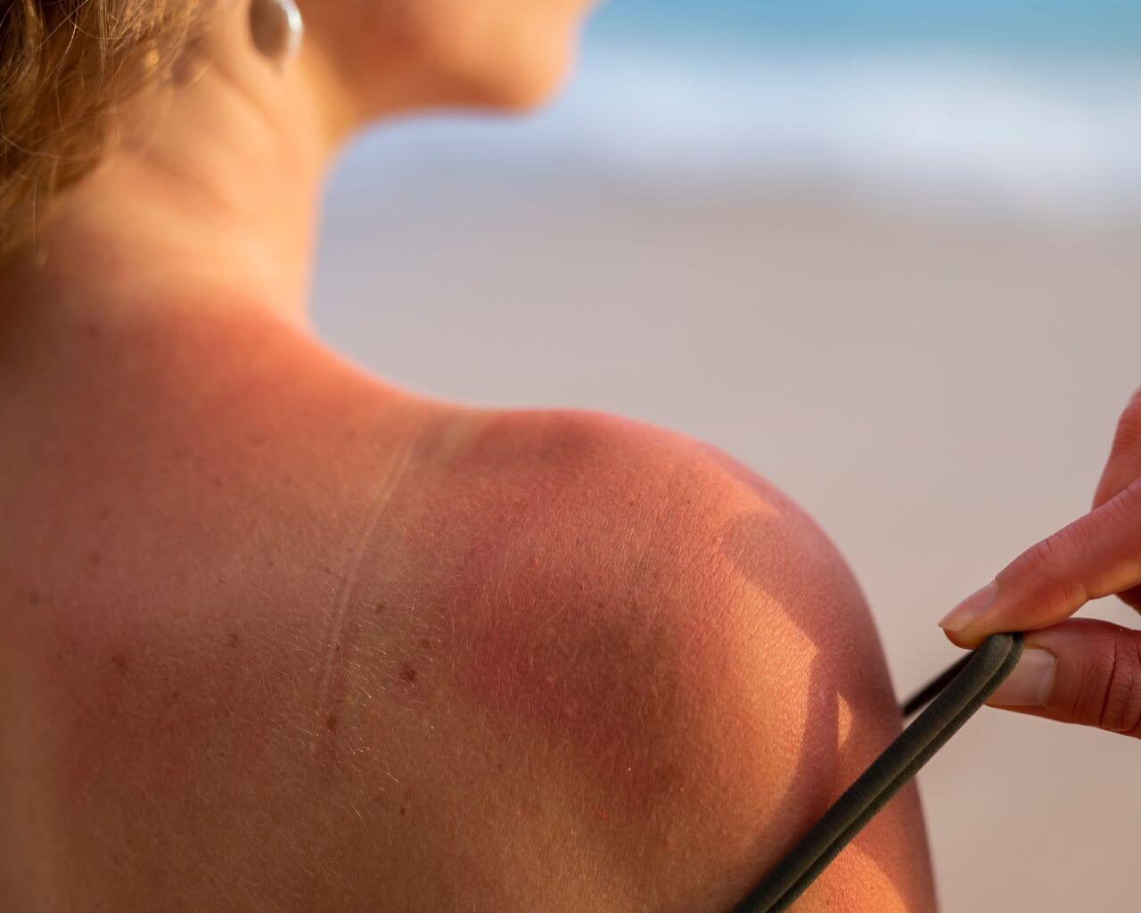 Cuidado con las olas de calor: consejos para evitar la insolación
