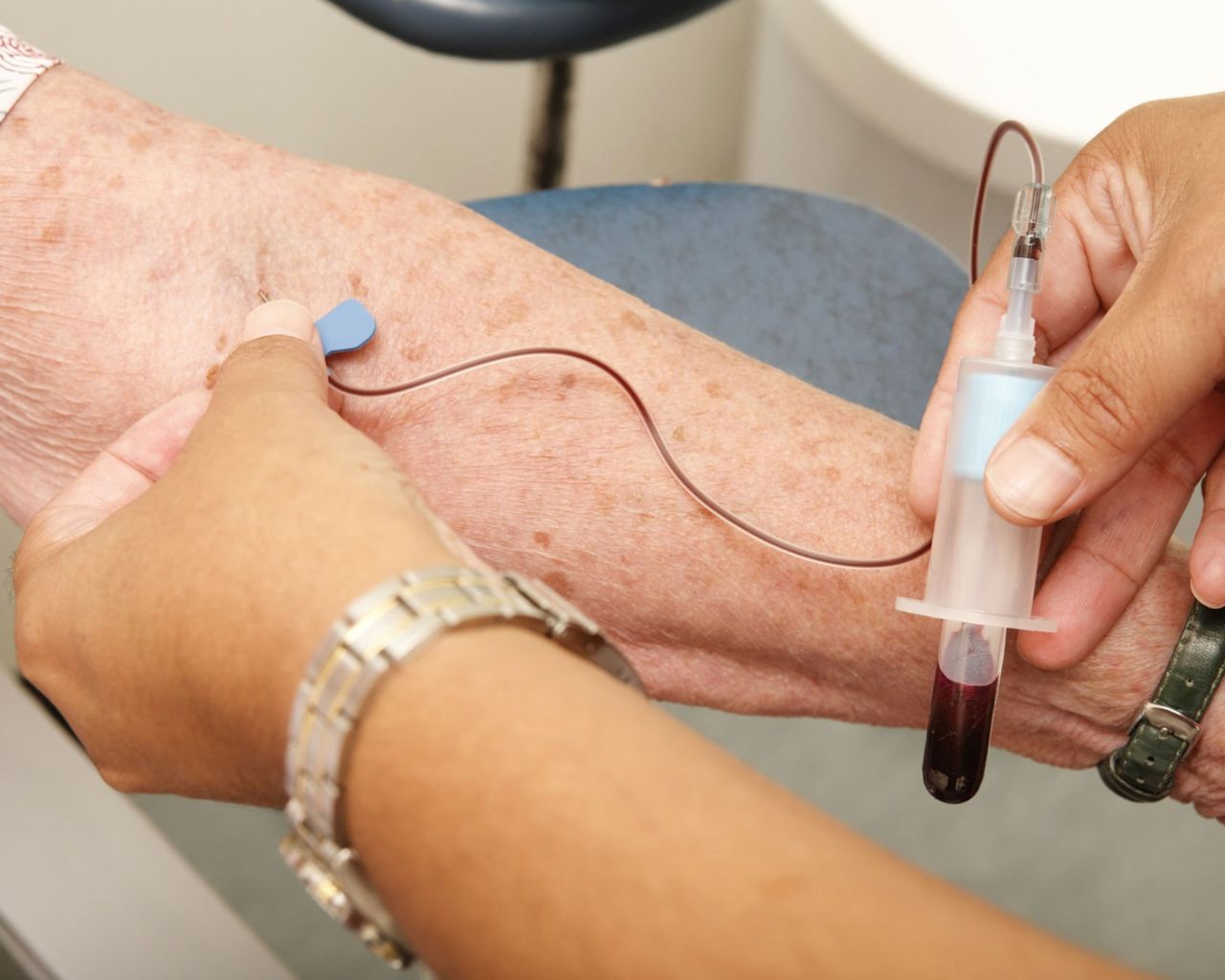 Estiman riesgo de fragilidad a partir de exámenes de sangre